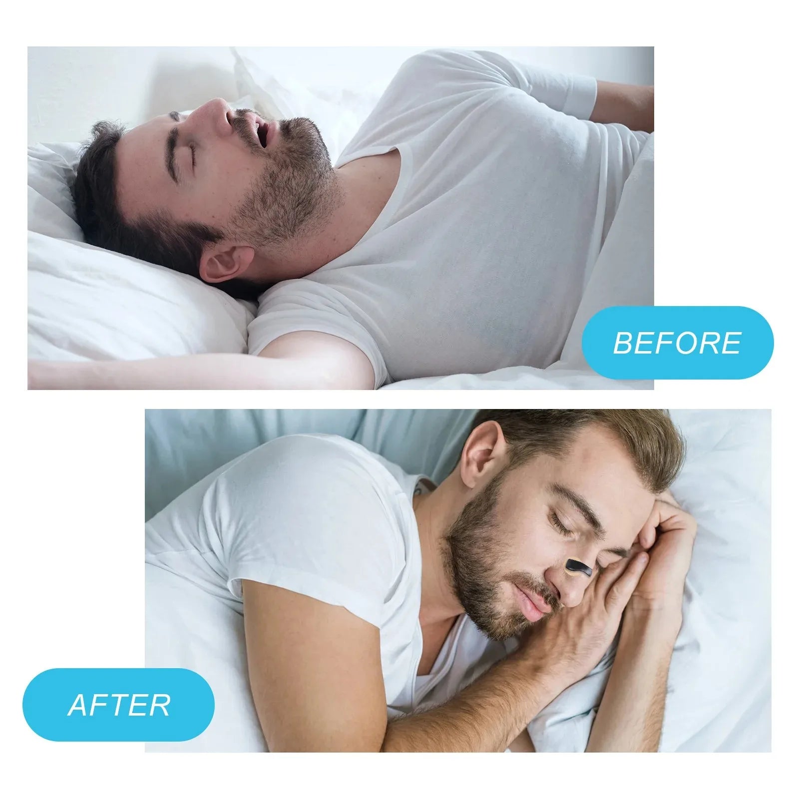 Nasal Breathing